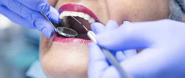 Best Emergency Dental Care for Sports Injuries in Hernando, MS